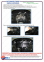 Захист двигуна SUBARU Legacy (2009-2014) 2,0; 2,5; 2,0D АКПП 3