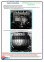 Захист двигуна та КПП CHEVROLET Aveo (2003+) 1,2; 1,4; 1,5; 1,6 0