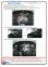 Защита двигателя SUBARU Outback (2009-2014) 2,0D; 2,5 АКПП 1