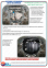 Защита двигателя и КПП HYUNDAI I30 (2007-2012) 1,4; 1,6; 2,0; 1,6CRDi; 2,0CRDi 4